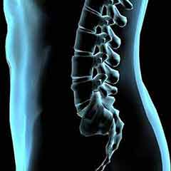 警惕！有這6種表現(xiàn)的人趕緊測骨密度！