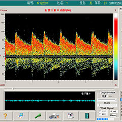 經(jīng)顱多普勒、磁共振和數(shù)字減影在腦血管病檢查中的優(yōu)缺點(diǎn)