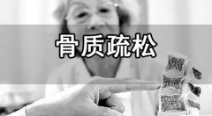 骨密度測量的時間和方法介紹