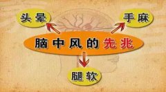 腦中風的前兆早知道 經顱多普勒幫助檢查腦血管疾病