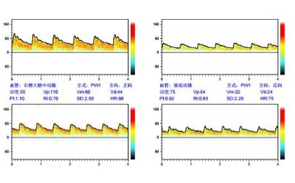 TCD報告預覽（示意）