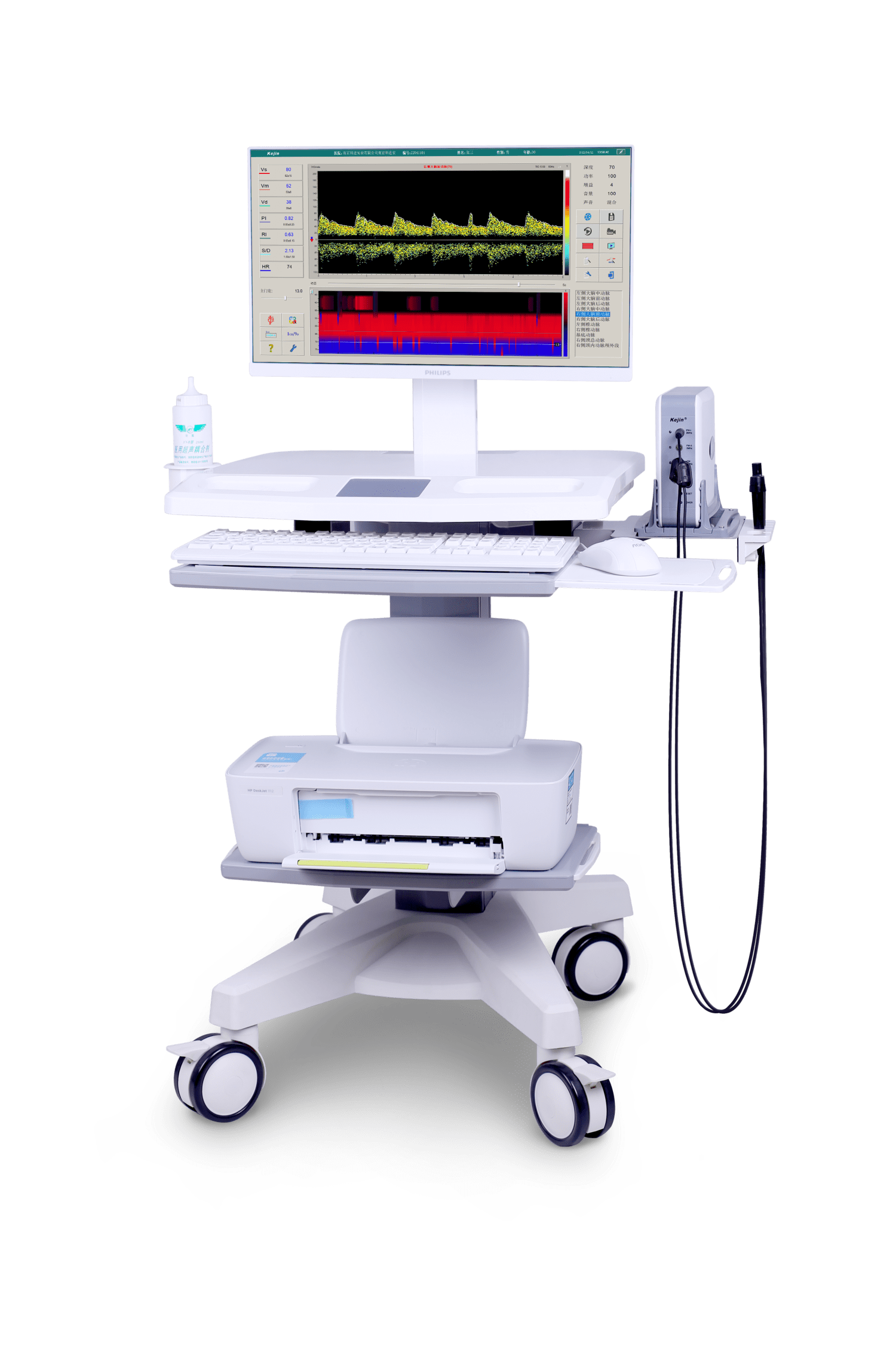超聲經顱多普勒血流分析儀廠家設備主機精修圖