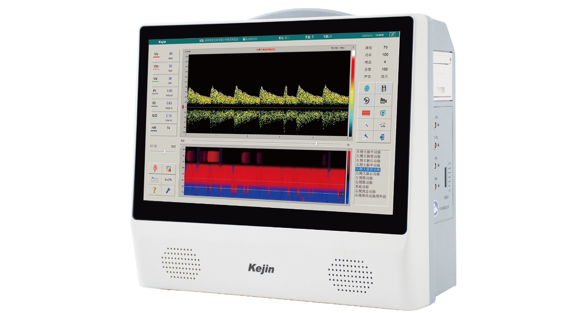 超聲經(jīng)顱多普勒血流分析儀應(yīng)用示意圖