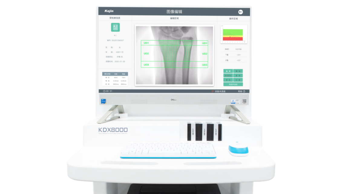 雙能X射線骨密度儀KDX8000系列應(yīng)用示意圖